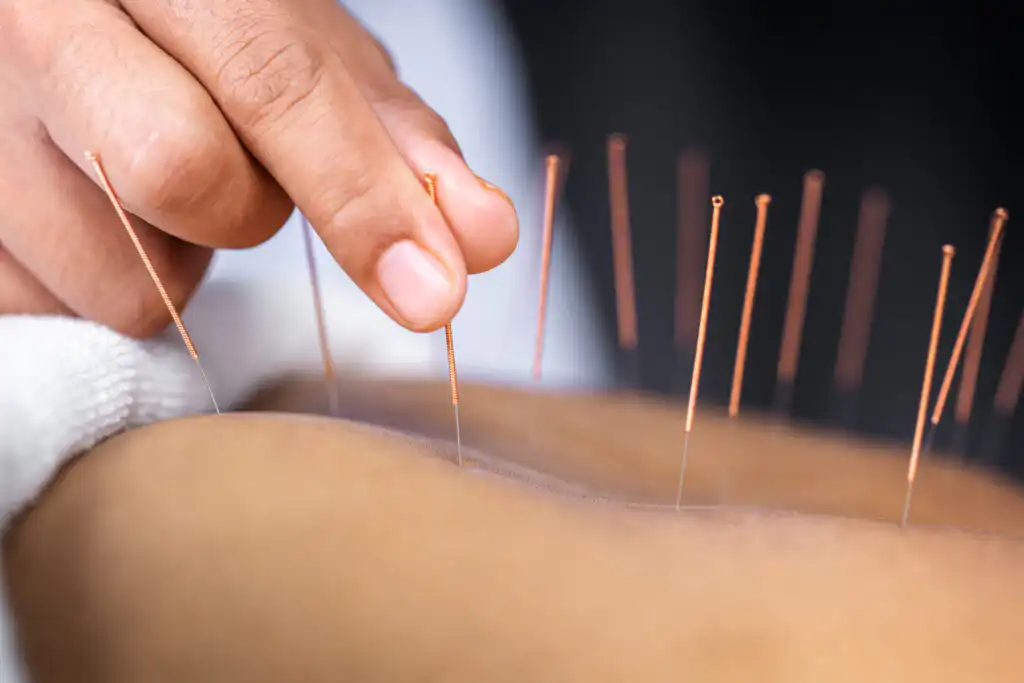 Alternative Medicine Puerto Vallarta